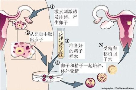 严重少弱精案例